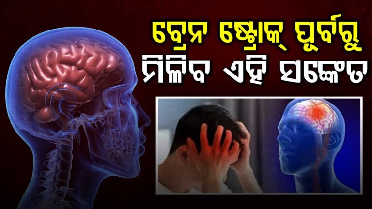 ବ୍ରେନ୍ ଷ୍ଟ୍ରୋକର ୫ଟି ଭୟଙ୍କର ଲକ୍ଷଣ… ”BEFAST” ଜାଣିଲେ ବଞ୍ଚିପାରିବ ଜୀବନ